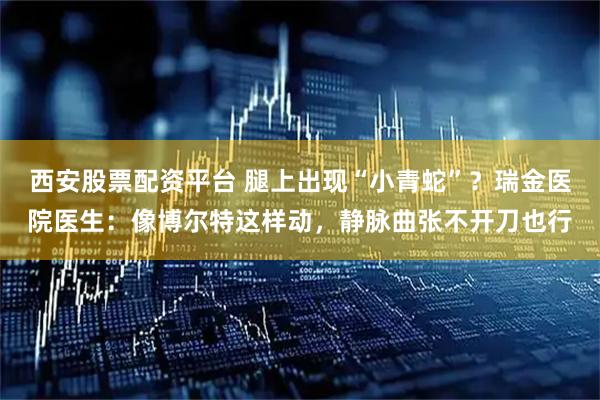 西安股票配资平台 腿上出现“小青蛇”？瑞金医院医生：像博尔特这样动，静脉曲张不开刀也行